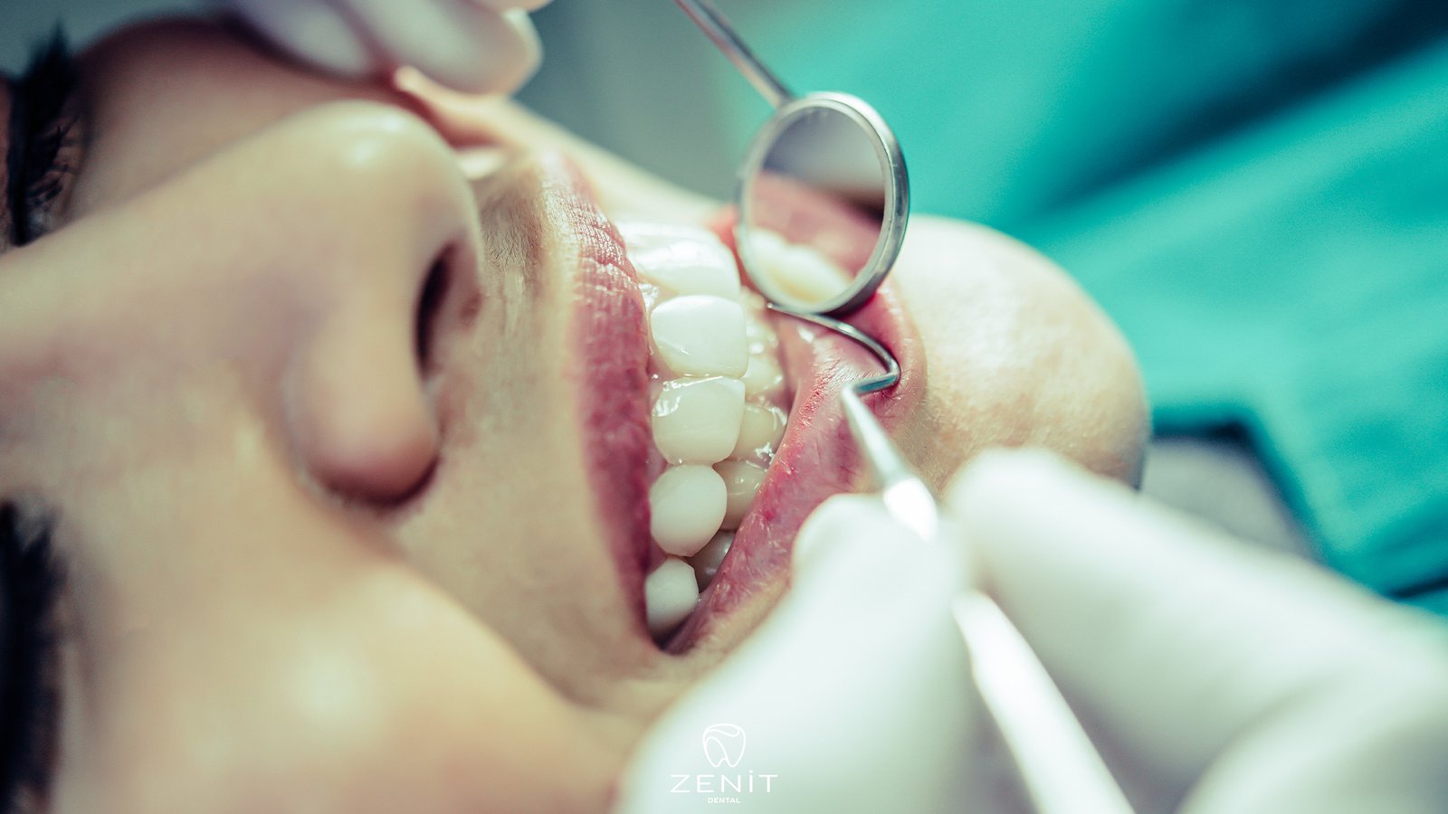 ağız ve çene cerrahisi