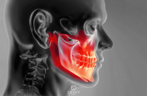 Çene Kasılması Neden Olur
